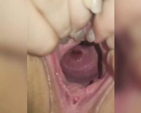 Wide open pussy and cervix show